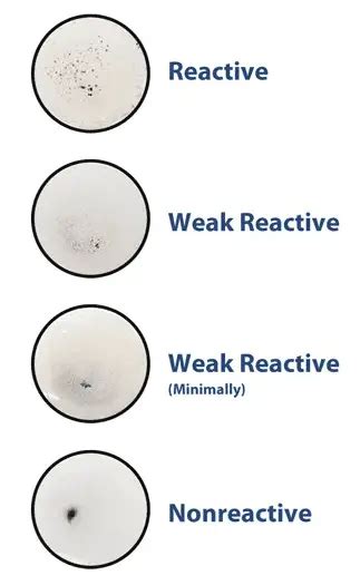 vdrl test non reactive